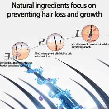 Имбирный шампунь Имбирный шампунь для восстановления роста волос Шампунь для глубокого очищения Восстанавливающий Сухие вьющиеся волосы Шампунь против выпадения волос для более длинных волос 1