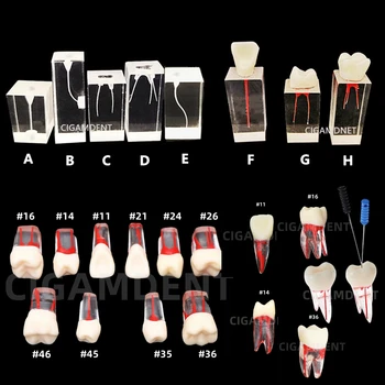 Стоматологическая модель, Эндодонтический блок корневых каналов, практика, изучение смолы в полости пульпы, эндопротезирование, Демонстрационное обучение RCT зубов